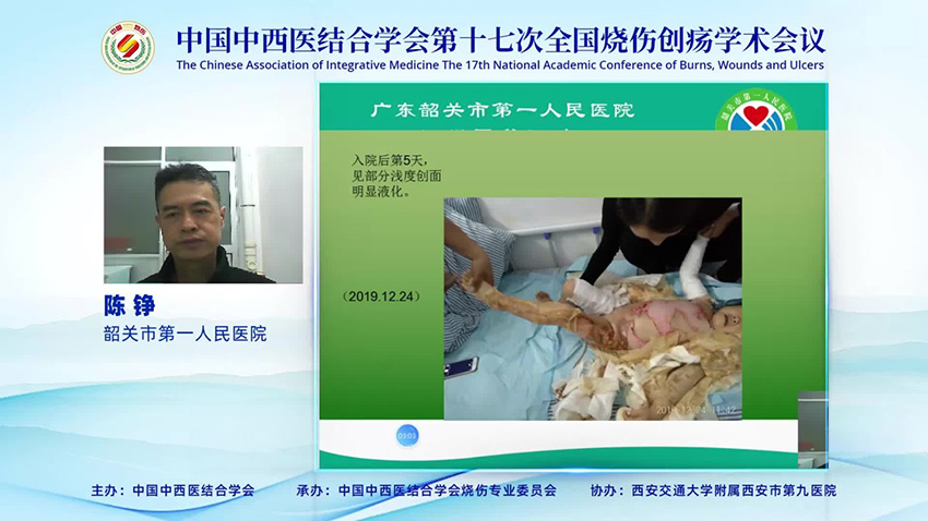 首页- 平博pinnacle888公司官网